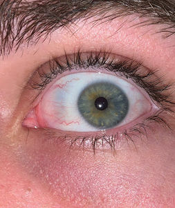 Meet your Posher, Johnny